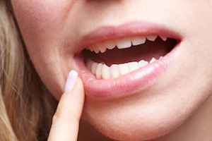 5 Causes of Sensitive Teeth