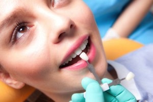 What You NEED To Know If You Are Considering Veneers