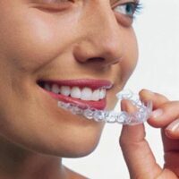 Invisalign® Gives You The Comfort And Confidence You’ve Been Looking For