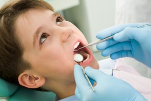 Sealants Help Fight Against Tooth Decay