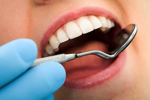 Just Brushing Twice A Day Won’t Keep The Cavities Away