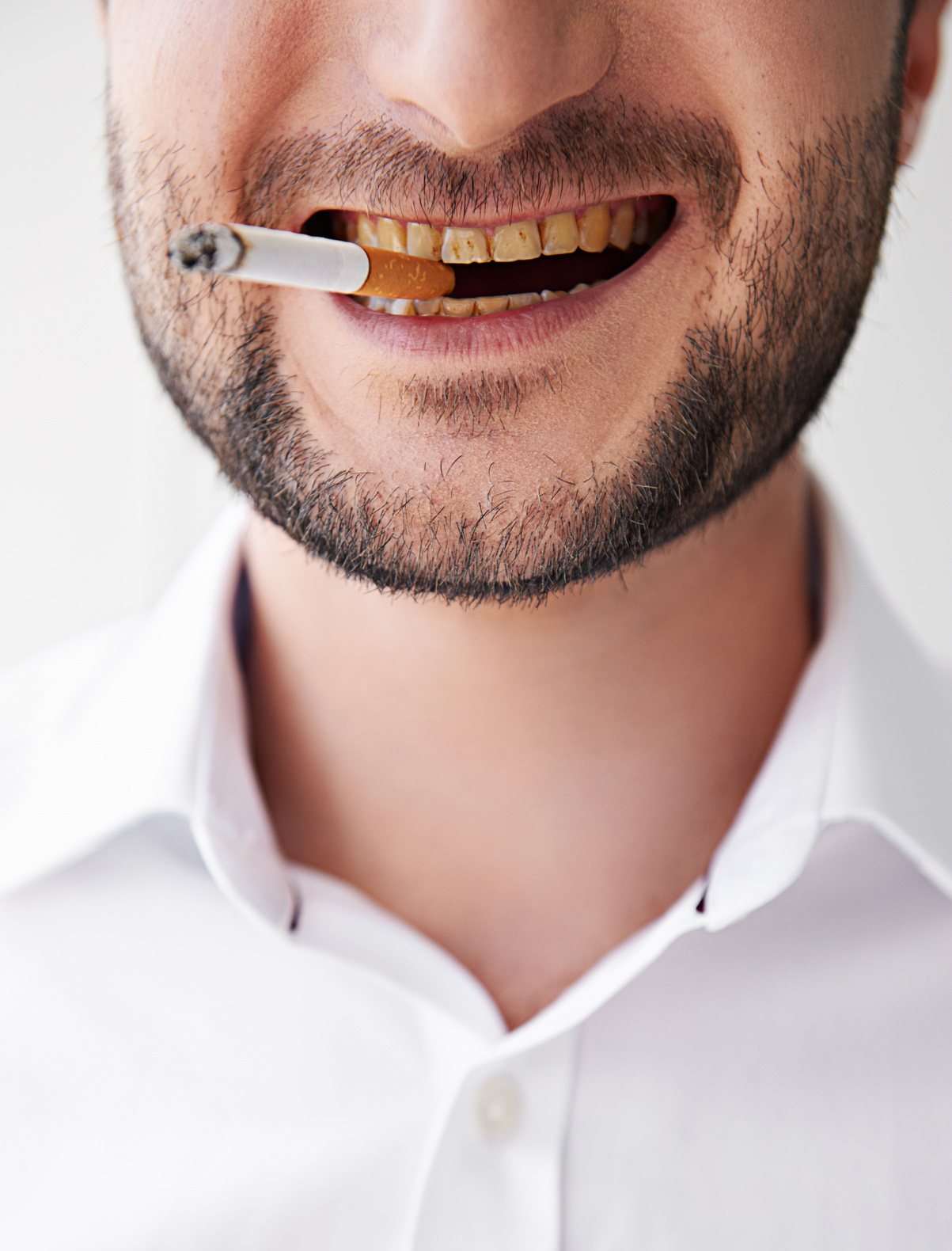 Smoking and dental care