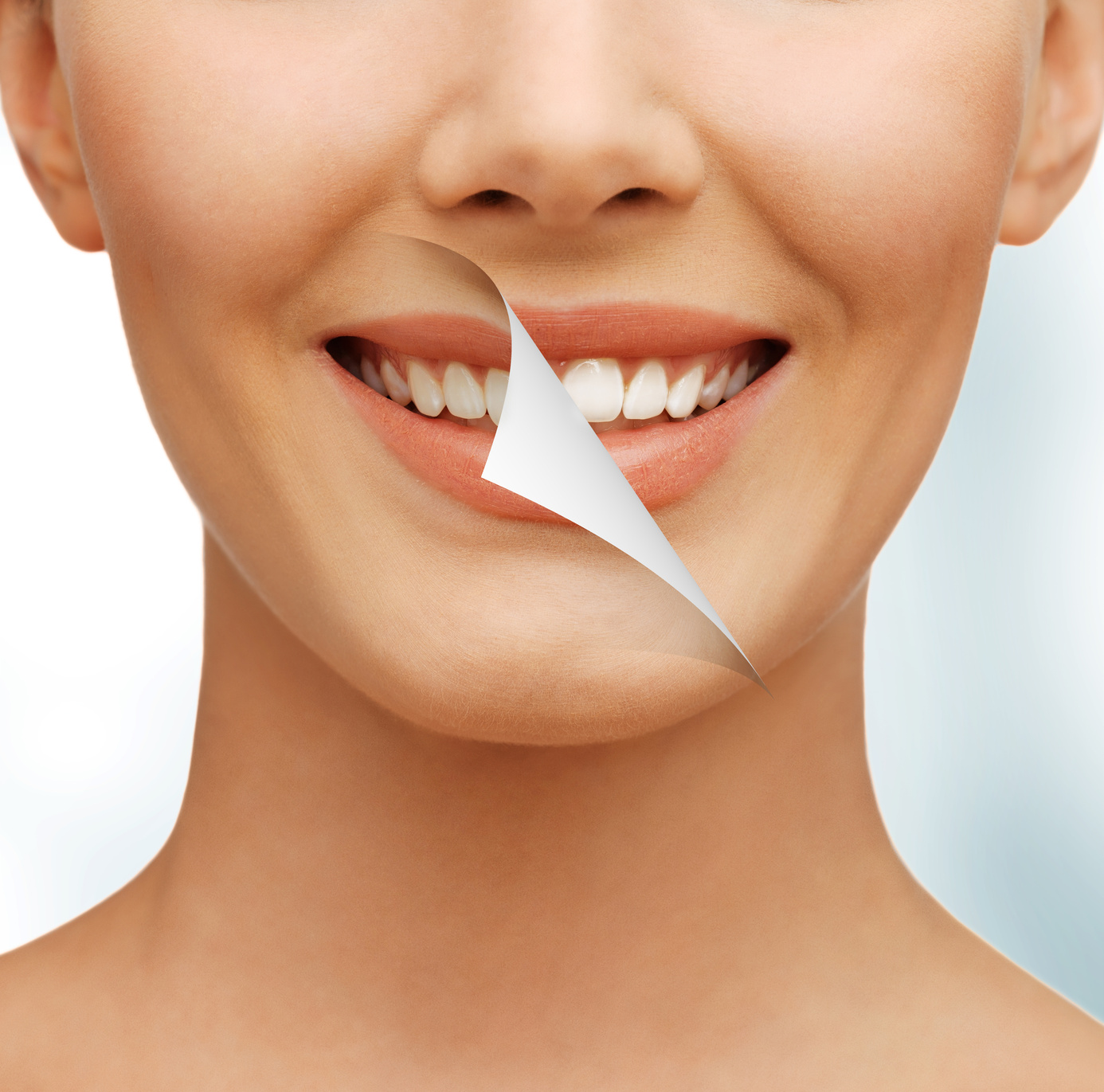 Why over the counter whiteners aren’t as effective