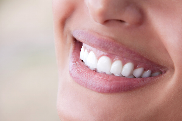 Experiencing acid reflux? Protect your enamel!
