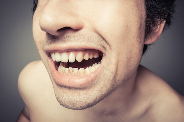 The Effects of Poor Dental Hygiene on Your Body:  Halitosis