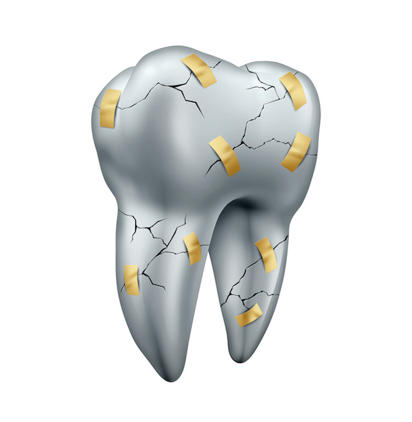 Clinical practice guidelines for caring for restorations