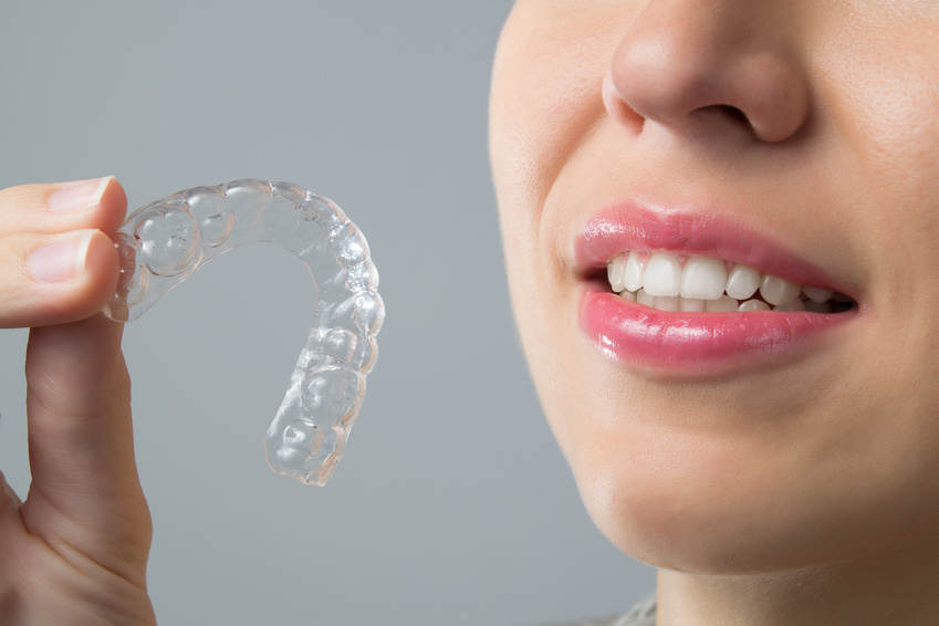 Smiling Woman with silicone trainer. Invisible braces