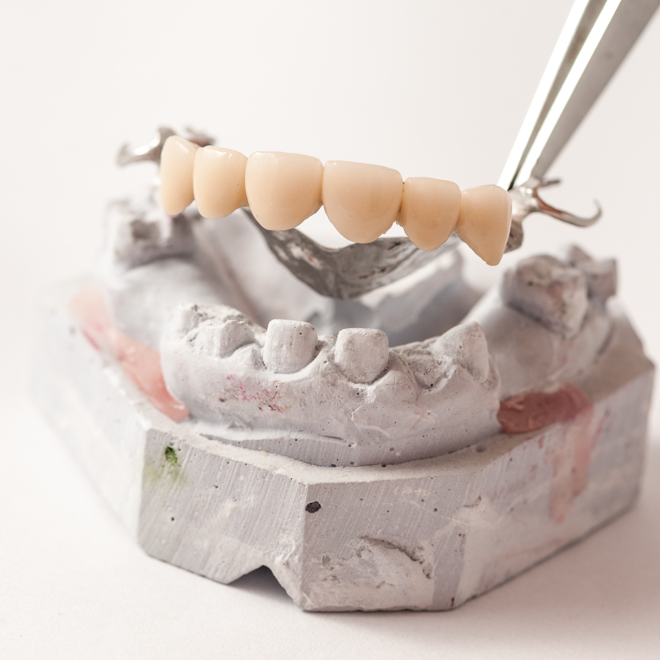 Dental Prothetic laboratory, technical shots