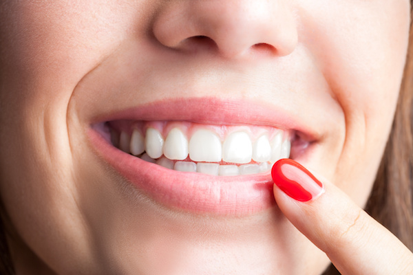 Cosmetic Dentistry San Diego