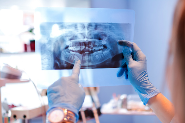 Close-up of female doctor pointing at teeth x-ray image at dental office.