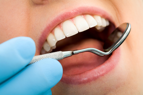 Plastic Fillings  Advantages of Composite Tooth Colored Fillings