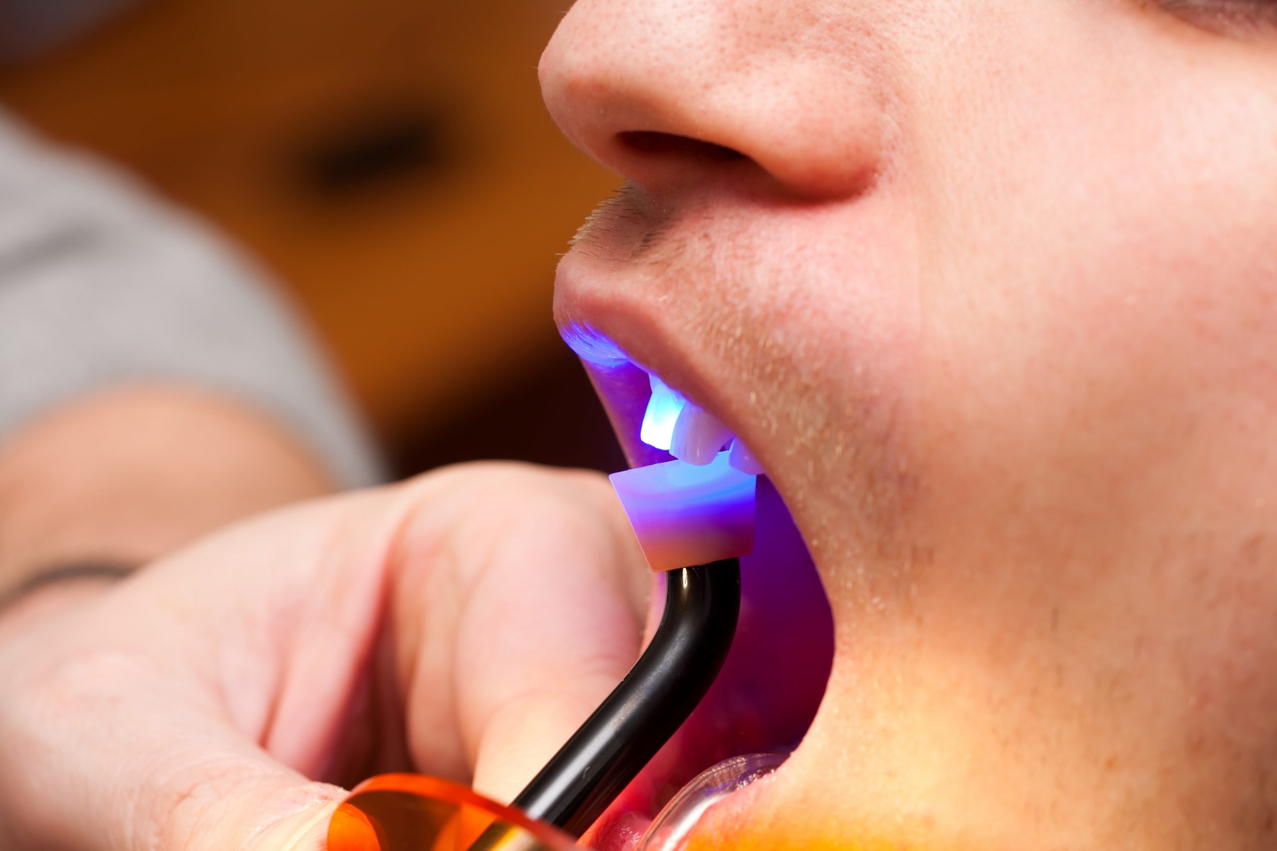 Dentist working with dental light.