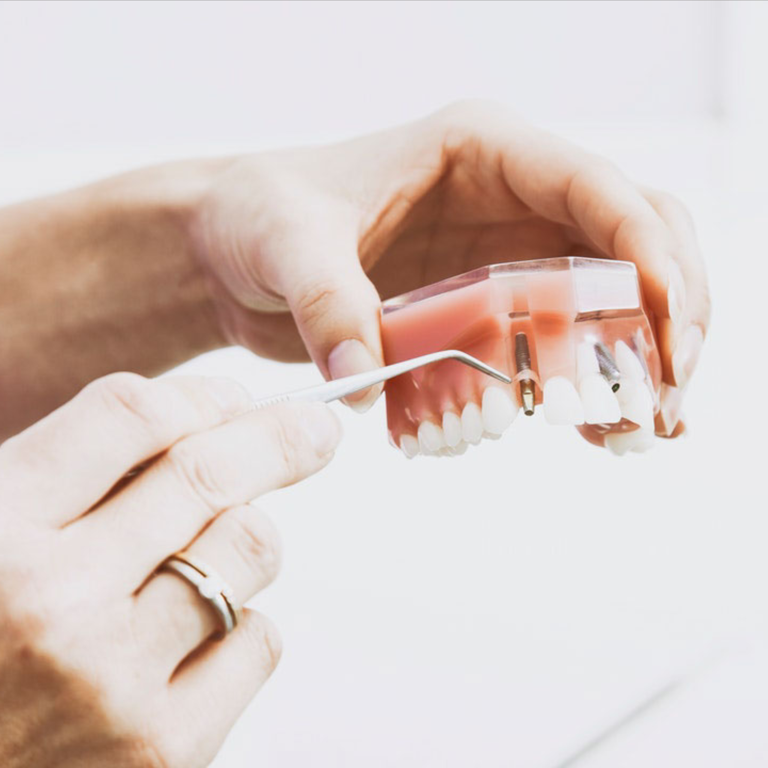 Dentist examining the root of a tooth for a cavity.