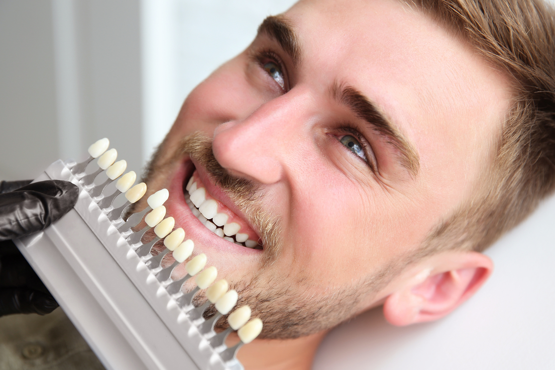 Young man choosing color of teeth at dentist.