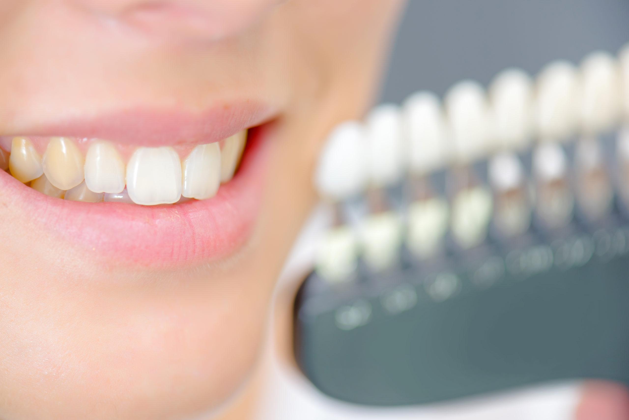 Lady smiling next to teeth samples yellow teeth smile