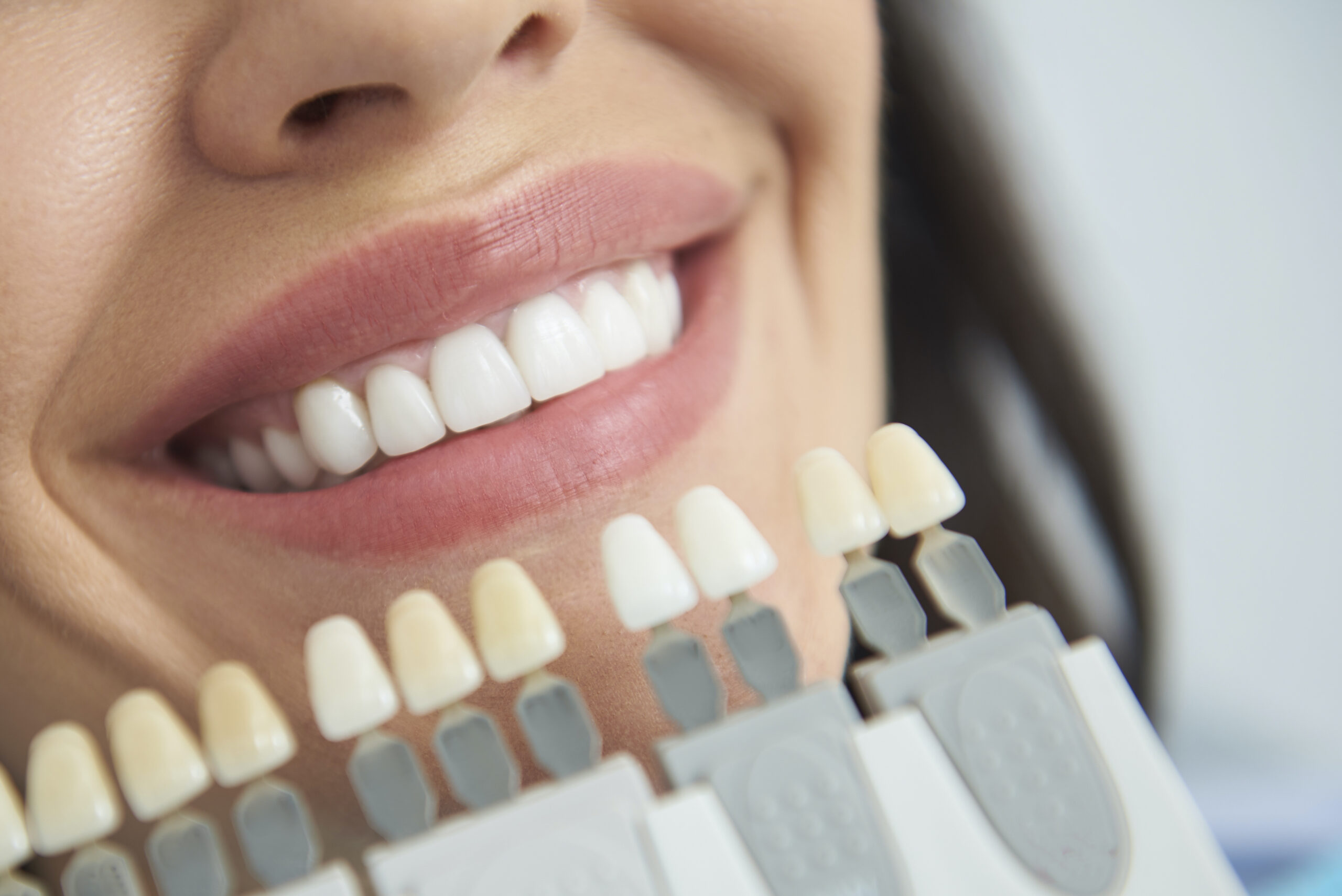 Close up mouth of smiling woman with dental crown situating near it