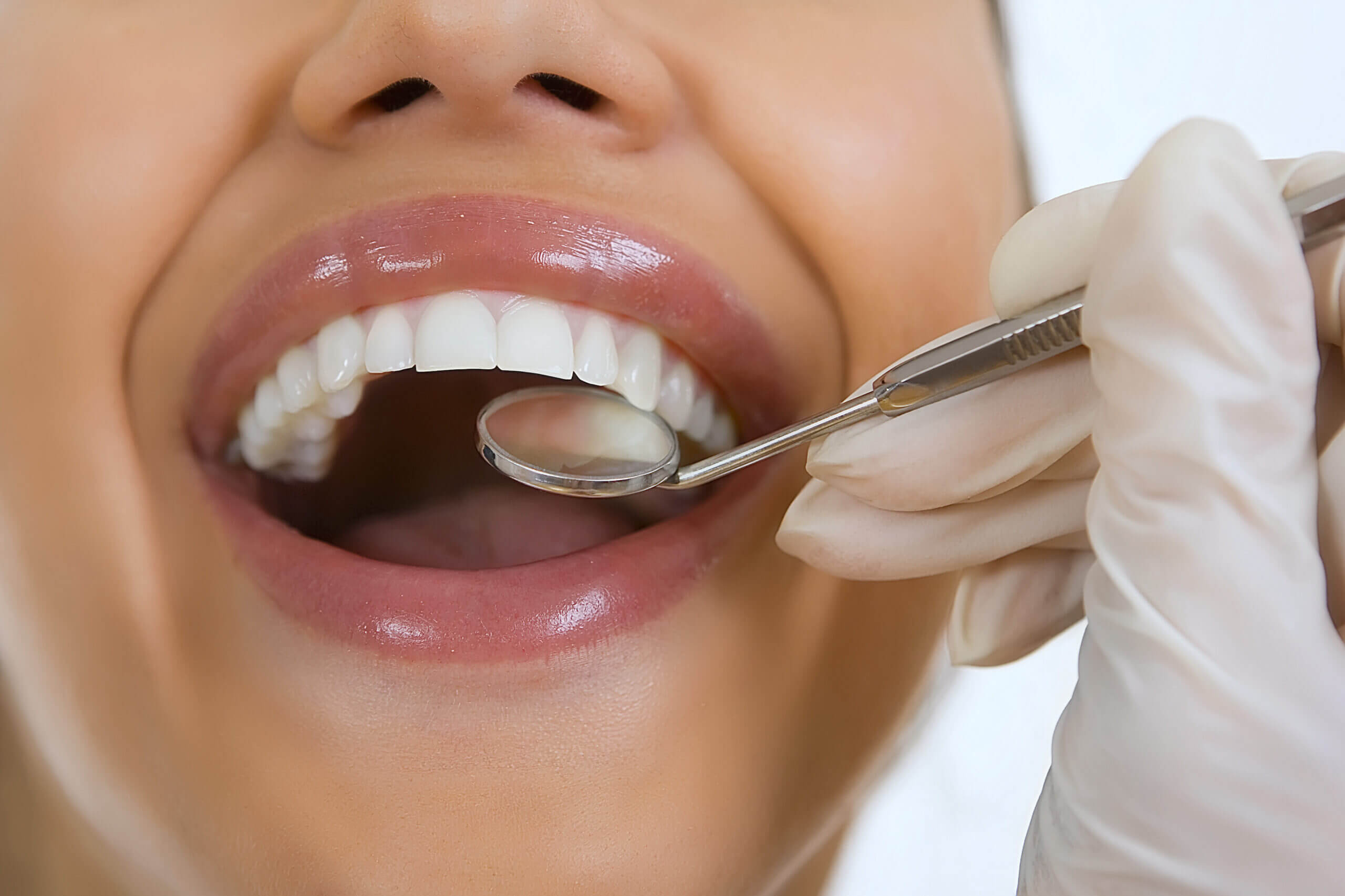 dental check ups and cleanings Close-up of female patient having her teeth examined by dentist, visit to the dentist, oral checkup with mirror