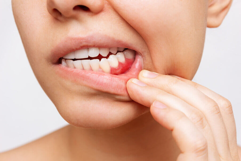 Periodontal Treatments periodontist Melbourne