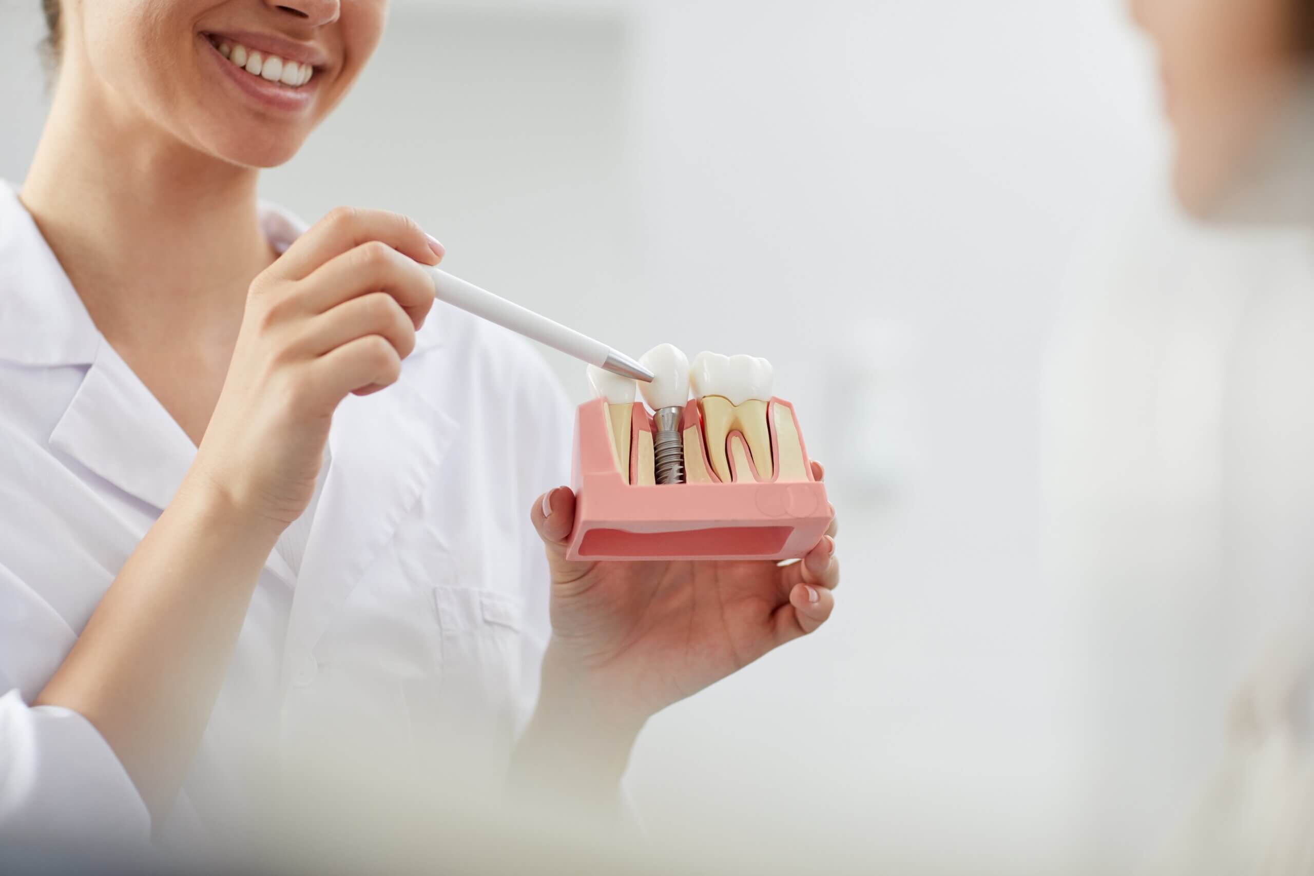Your Guide to Dental Implants: Myths and Facts  