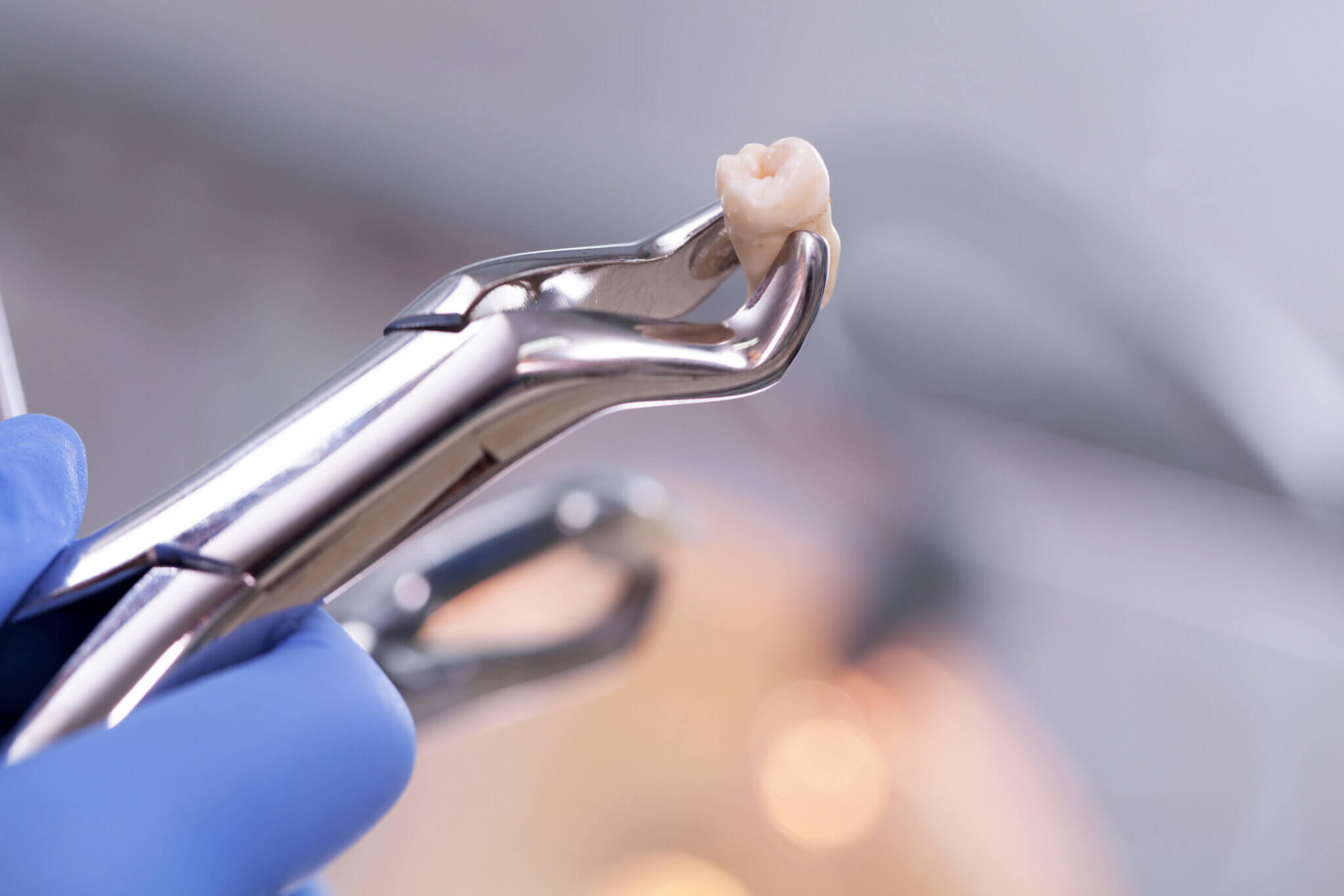 Dentists offering same-day extractions near me
