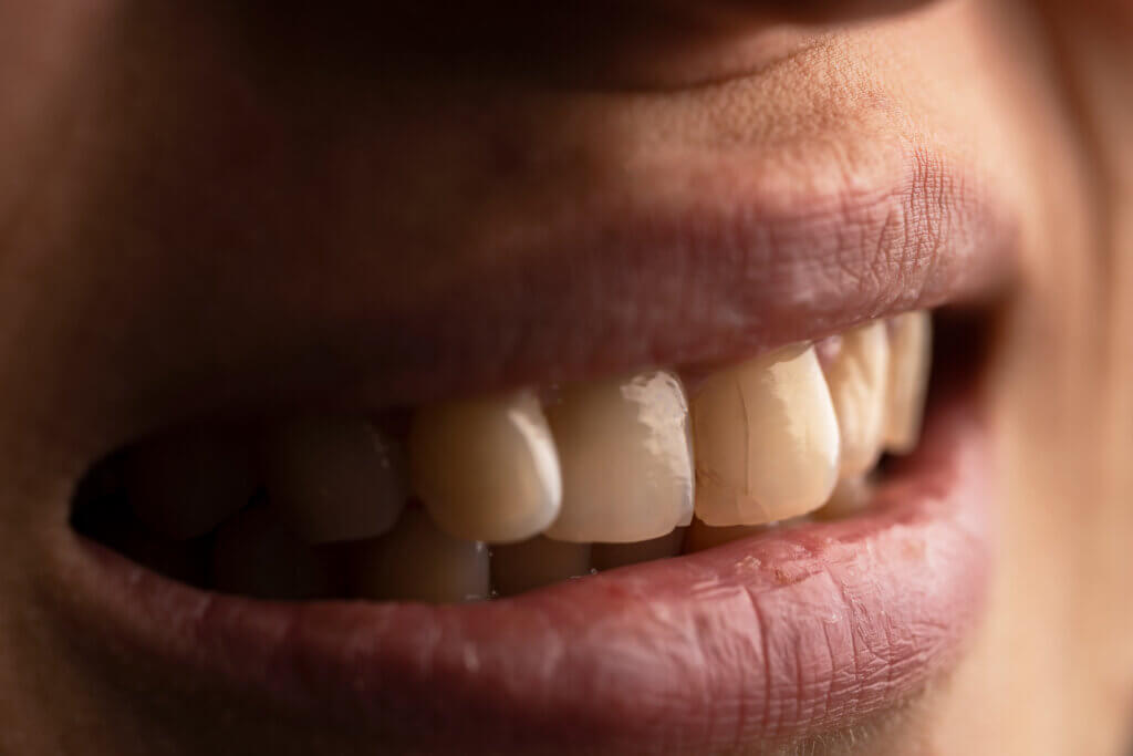 dentist in West Melbourne 